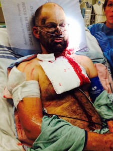 Chad Dueck in hospital shortly after the Sept. 1 grizzly bear attack.